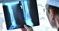 Рентген пятки (пяточной кости)